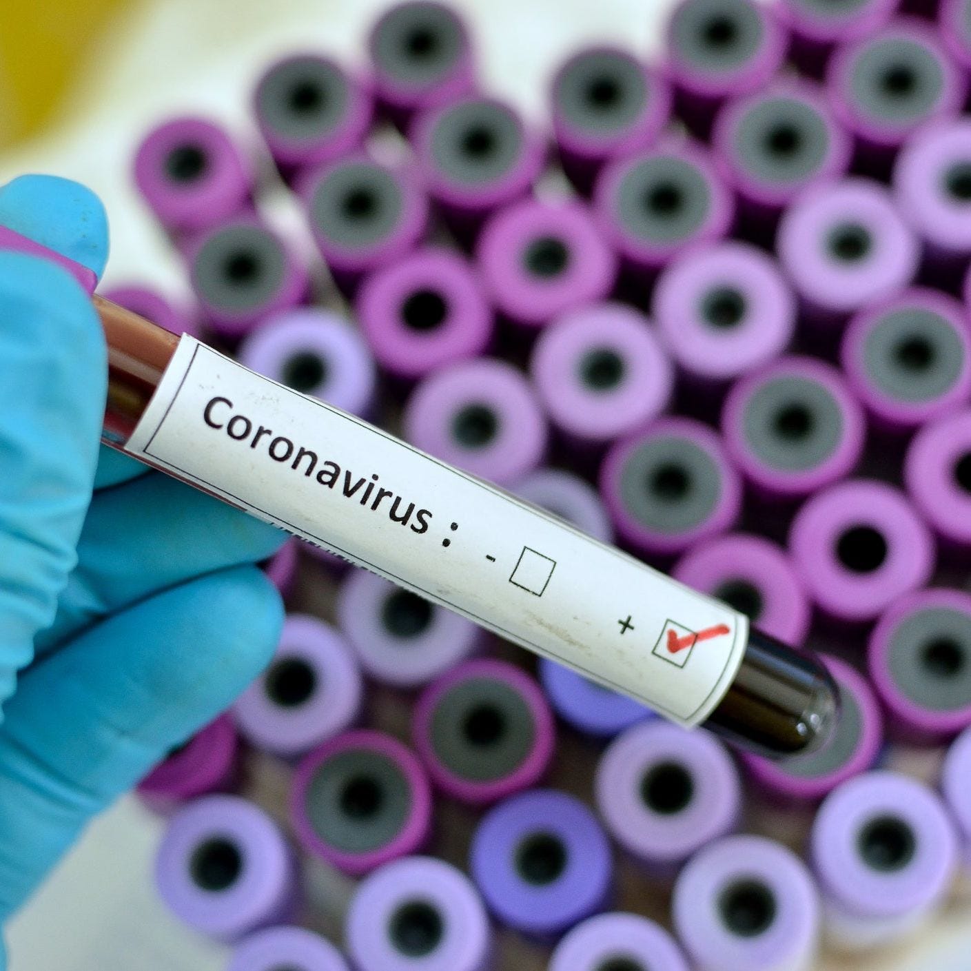 14 individuals have been tested for coronavirus in Wisconsin